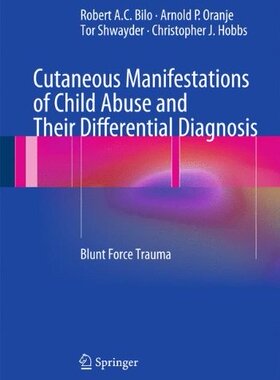 【预订】Cutaneous Manifestations of Child Abuse and Their Differential Diagnosis