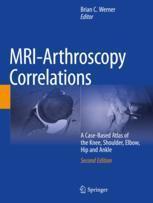 [预订]MRI-Arthroscopy Correlations 9783030947910