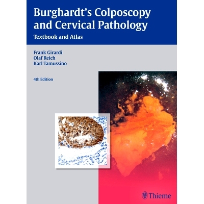 预订 Burghardt’s Colposcopy and Cervical Pathology: Textbook and Atlas Burghardt 的*镜检查和宫颈病理学: 978313659904