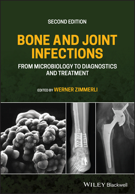 【预订】Bone And Joint Infections - From Microbiology To Diagnostics And Treatment, Second Edition 9781119720652