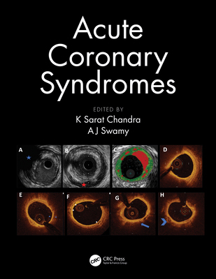 【预订】Acute Coronary Syndromes