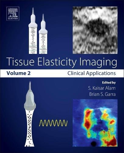 【预订】Tissue Elasticity Imaging