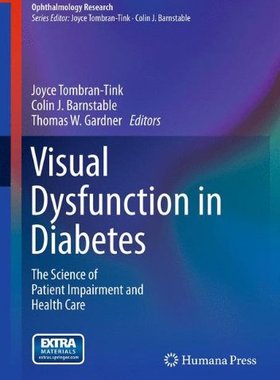 【预订】Visual Dysfunction in Diabetes