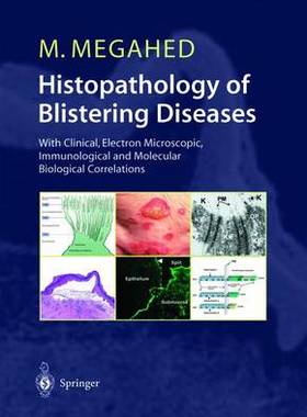 【预订】Histopathology of Blistering Diseases