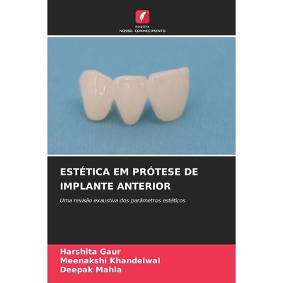 预订 Estética Em Prótese De Implante Anterior: Uma revisão exaustiva dos parâmetros estéticos: 9786209105807