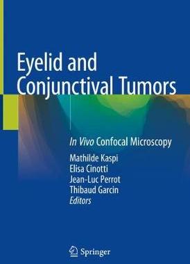 【预订】Eyelid and Conjunctival Tumors