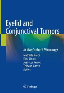 【预订】Eyelid and Conjunctival Tumors