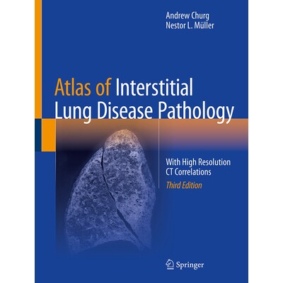 预订 Atlas of Interstitial Lung Disease Pathology With High Resolution CT Correlations 间质性肺疾病病理图谱:具有高分辨