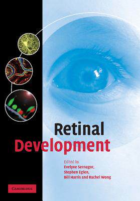 【预订】Retinal Development