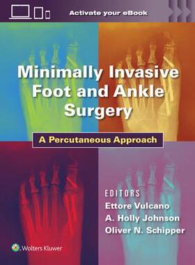 [预订]Minimally Invasive Foot and Ankle Surgery: A Percutaneous Approach 9781975198701