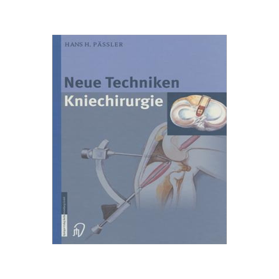 预订 Neue Techniken Kniechirurgie