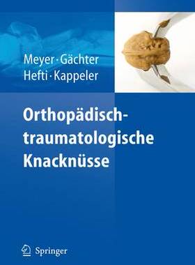 预订 Orthopädisch-traumatologische Knacknüsse