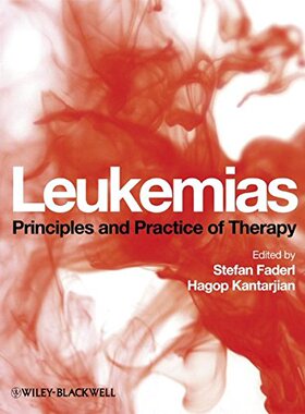 【预订】Leukemias - Principles and Practice of Therapy