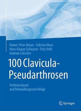 预订 100 Clavicula-Pseudarthrosen