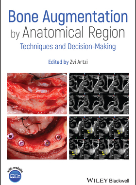 【预订】Bone Augmentation By Anatomical Region - Techniques And Decision-Making