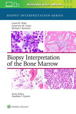 [预订]Biopsy Interpretation of the Bone Marrow 9781496300591