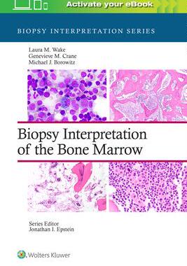 [预订]Biopsy Interpretation of the Bone Marrow 9781496300591
