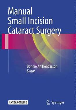 预订 Manual Small Incision Cataract Surgery