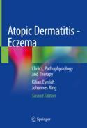 【预订】Atopic Dermatitis - Eczema: Clinics, Pathophysiology and Therapy 9783031124983