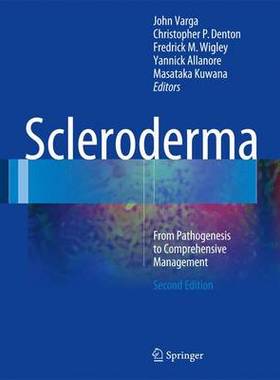 【预订】Scleroderma