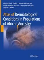 [预订]Atlas of Dermatological Conditions in Populations of African Ancestry 9783030726164