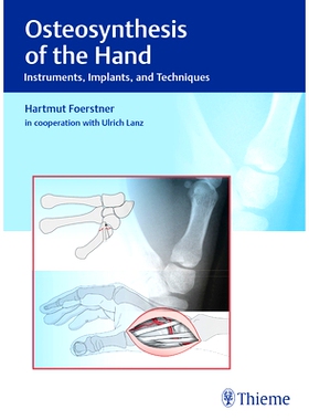 预订 Osteosynthesis of the Hand: Instruments, Implants, and Techniques 手的骨合成：器械，植入物和技术: 9783132038110