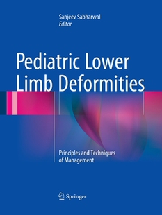 Lower 预订 Pediatric Deformities Limb