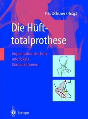 预订 Die Hüfttotalprothese