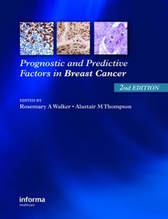 and Predictive Factors Breast Prognostic Cancer 预订