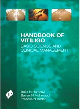 预订 Handbook of Vitiligo: Basic Science and Clinical Management: 9781907816963