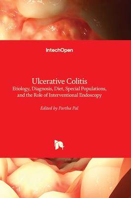 [预订]Ulcerative Colitis - Etiology, Diagnosis, Diet, Special Populations, and the Role of Interventional  9781803552941