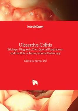 [预订]Ulcerative Colitis - Etiology, Diagnosis, Diet, Special Populations, and the Role of Interventional  9781803552941
