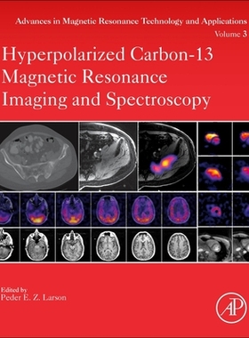 【预订】Hyperpolarized Carbon-13 Magnetic Resonance Imaging and Spectroscopy, 3 9780128222690