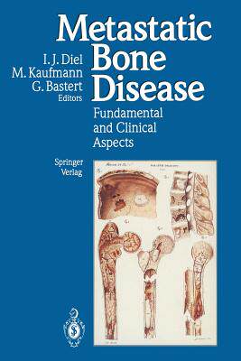 预订 Metastatic Bone Disease