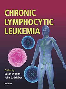 【预订】Chronic Lymphocytic Leukemia