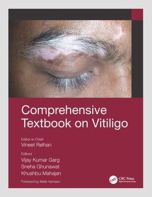 【预订】Comprehensive Textbook on Vitiligo 9780367543723