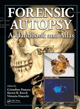 【预订】Forensic Autopsy