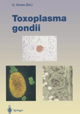 预订 Toxoplasma gondii