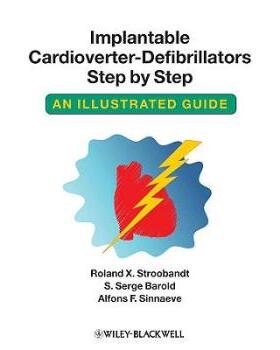 【预售】Implantable Cardioverter - Defibrillators Step by Step - an Illustrated Guide