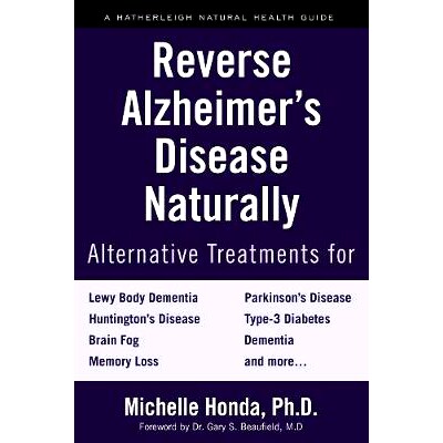 预订 Reverse Alzheimer’s Disease Naturally: Alternative Treatments for Dementia including Alzheimer’s Disease: Alterna