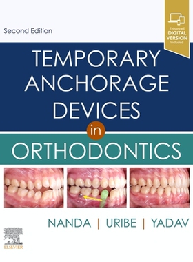 【预订】Temporary Anchorage Devices in Orthodontics
