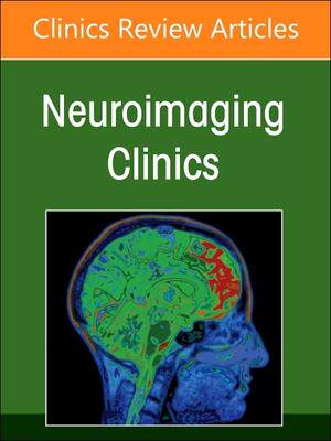 [预订]MRI and Traumatic Brain Injury, an Issue of Neuroimaging Clinics of North America 9780323972864