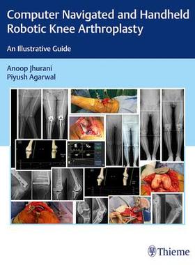 [预订]Computer Navigated and Handheld Robotic Knee Arthroplasty 9789390553402