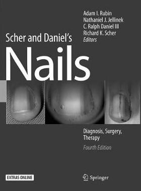 【预订】Scher and Daniel’s Nails 9783030097448
