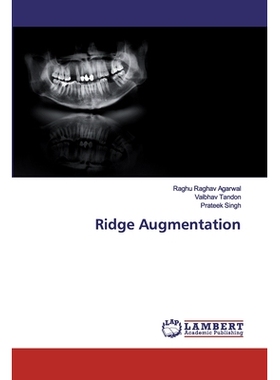 预订 Ridge Augmentation 岭增强: 9786200507709