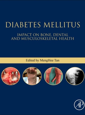 【预订】Diabetes Mellitus