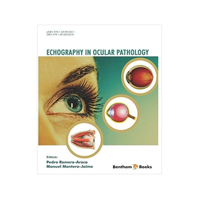 [预订]Echography in Ocular Pathology 9781681080338