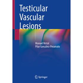 预订 Testicular Vascular Lesions