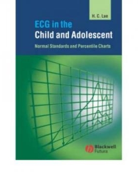 预订 Ecg In The Child And Adolescent - Normal Standards And Percentile Charts 儿童与青少年心电图：正常标准与百分位图: 97