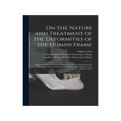 [预订]On the Nature and Treatment of the Deformities of the Human Frame [electronic Resource]: Being a Cou 9781015156869